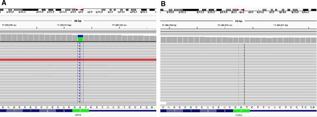 【佳学基因检测】质谱基因评估分析COX7C基因存在基因突变该怎么理解？